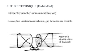 SUTURE TECHNIQUE (End-to-End)
Kleinert (Bunnel crisscross modification)
• easier, less intratendinous ischemia, gap formation are possible.
 