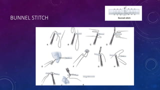 TENDON REPAIR – PRINCIPLES ^0 TYPES-1.pptx