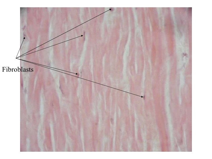tendons ligaments