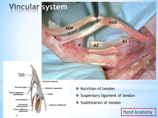 flexor tendon surgery