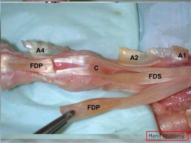 flexor tendon surgery
