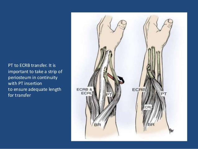 fcr tendon