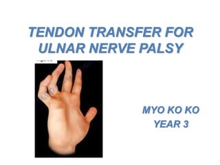 TENDON TRANSFER FOR
ULNAR NERVE PALSY
MYO KO KO
YEAR 3
 