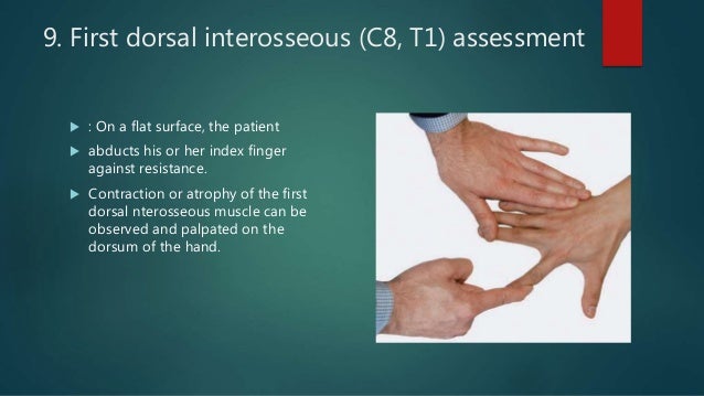 ULNAR NERVE PALSY AND TENDON TRANSFERS