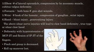 3.Elbow -# of lateral epicondyle, compression by he accessory muscle,
cubitus valgus deformity.
4.Forearm - both bone # ,gun shot wounds.
5.Wrist - # hook of the hamate , compression of ganglion , wrist injury.
6.Hand – blunt injury , penetrationg injury.
The above ulnar nerve injuries will lead to claw hand deformity , true type
or ulnar claw hand
• Deformity with hyperextension of
MCP JT and flexion of IP JT of the
fingers.
• Pinch and grasp is decreased.
• Roll up manevor lost.
 