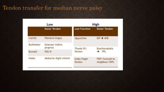 Tendon transfer for median nerve palsy
 
