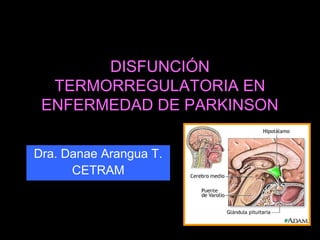 DISFUNCIÓN 
TERMORREGULATORIA EN 
ENFERMEDAD DE PARKINSON 
Dra. Danae Arangua T. 
CETRAM 
 