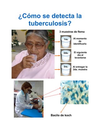 tenfermedad de la tuberculosis.pdf