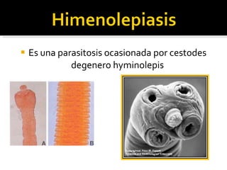 Es una parasitosis ocasionada por cestodes  degenero hyminolepis  
