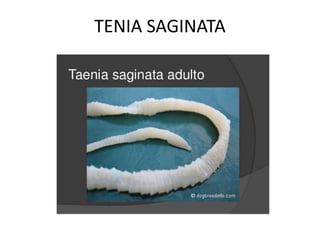 TENIA SAGINATA
 