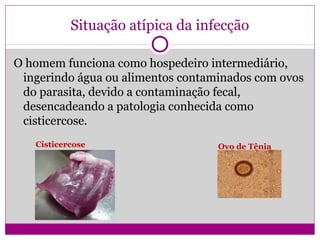 Situação atípica da infecção
O homem funciona como hospedeiro intermediário,
ingerindo água ou alimentos contaminados com ovos
do parasita, devido a contaminação fecal,
desencadeando a patologia conhecida como
cisticercose.
Ovo de TêniaCisticercose
 