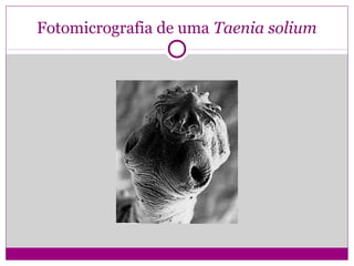 Fotomicrografia de uma Taenia solium
 
