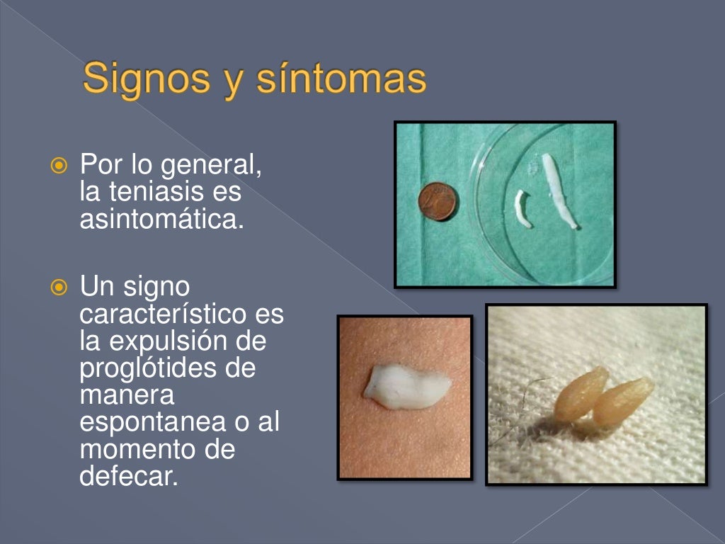 Teniasis