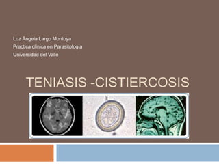 TENIASIS -CISTIERCOSIS
Luz Ángela Largo Montoya
Practica clínica en Parasitología
Universidad del Valle
 