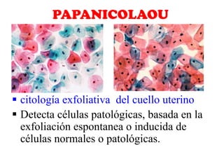  citología exfoliativa del cuello uterino
 Detecta células patológicas, basada en la
exfoliación espontanea o inducida d...