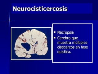 Neurocisticercosis


                Necropsia
                Cerebro que
                 muestra múltiples
                 cisticercos en fase
                 quistica.
 