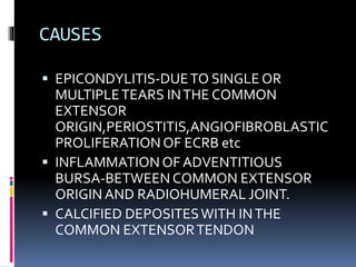CAUSES
 EPICONDYLITIS-DUETO SINGLE OR
MULTIPLETEARS INTHE COMMON
EXTENSOR
ORIGIN,PERIOSTITIS,ANGIOFIBROBLASTIC
PROLIFERATIONOF ECRB etc
 INFLAMMATION OF ADVENTITIOUS
BURSA-BETWEEN COMMON EXTENSOR
ORIGIN AND RADIOHUMERAL JOINT.
 CALCIFIED DEPOSITESWITH INTHE
COMMON EXTENSORTENDON
 