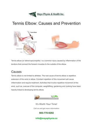 Tennis Elbow: Causes and Prevention
Tennis elbow (or lateral epicondylitis) is a common injury caused by inflammation of the
tendons that connect the forearm muscles to the outside of the elbow.
Causes
Tennis elbow is not limited to athletes. The root cause of tennis elbow is repetitive
extension of the wrist or elbow. Constant repetition of this movement will cause
inflammation and require treatment. Activities that involve repetitive movement of the
wrist, such as; overuse of the computer, weightlifting, gardening and cooking have been
heavily linked to developing tennis elbow.
It's Worth Your Time!
Call us and get more information
905-770-9292
info@mayaphysio.ca
 