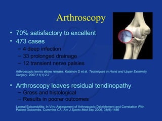 Arthroscopy 
• 70% satisfactory to excellent 
• 473 cases 
– 4 deep infection 
– 33 prolonged drainage 
– 12 transient nerve palsies 
Arthroscopic tennis elbow release. Kalainov D et al. Techniques in Hand and Upper Extremity 
Surgery. 2007;11(1):2-7 
• Arthroscopy leaves residual tendinopathy 
– Gross and histological 
– Results in poorer outcomes 
Lateral Epicondylitis: In Vivo Assessment of Arthroscopic Debridement and Correlation With 
Patient Outcomes. Cummins CA. Am J Sports Med Sep 2006, 34(9):1486 
 