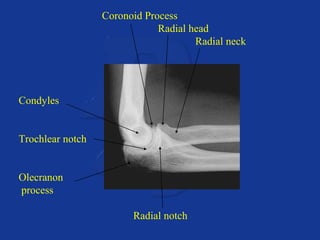 Coronoid Process 
Radial head 
Radial neck 
Condyles 
Trochlear notch 
Olecranon 
process 
Radial notch 
 