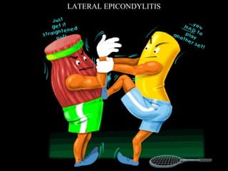 LATERAL EPICONDYLITIS 
 
