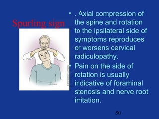 50 
Spurling sign 
• . Axial compression of 
the spine and rotation 
to the ipsilateral side of 
symptoms reproduces 
or worsens cervical 
radiculopathy. 
• Pain on the side of 
rotation is usually 
indicative of foraminal 
stenosis and nerve root 
irritation. 
 