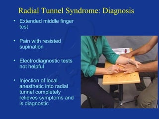 Radial Tunnel Syndrome: Diagnosis 
• Extended middle finger 
test 
• Pain with resisted 
supination 
• Electrodiagnostic tests 
not helpful 
• Injection of local 
anesthetic into radial 
tunnel completely 
relieves symptoms and 
is diagnostic 
 