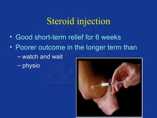 Steroid injection 
• Good short-term relief for 6 weeks 
• Poorer outcome in the longer term than 
– watch and wait 
– physio 
 