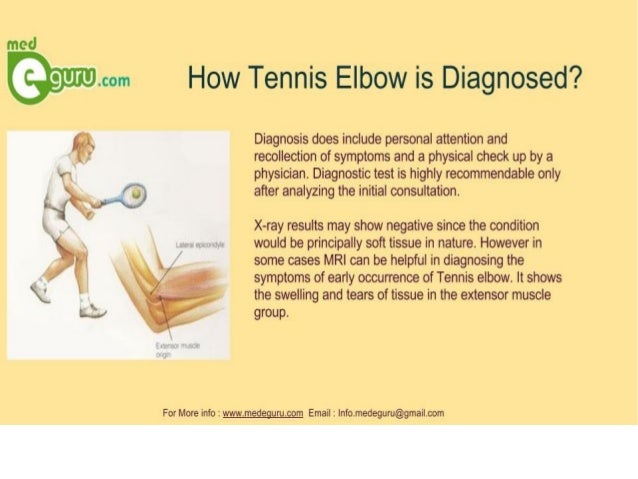 What are the symptoms of tennis elbow?