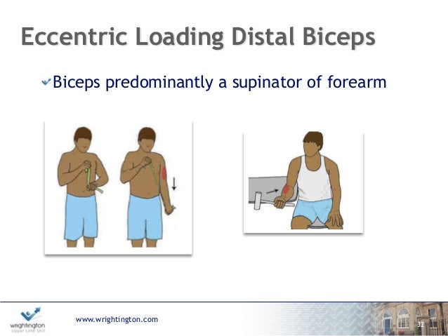 Eccentric Exercises For Distal Biceps Tendonitis - Exercise Poster Eccentric Exercises For Distal Biceps Tendonitis - Exercise Poster