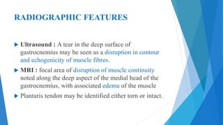 RADIOGRAPHIC FEATURES
 Ultrasound : A tear in the deep surface of
gastrocnemius may be seen as a disruption in contour
and echogenicity of muscle fibres.
 MRI : focal area of disruption of muscle continuity
noted along the deep aspect of the medial head of the
gastrocnemius, with associated edema of the muscle
 Plantaris tendon may be identified either torn or intact.
 