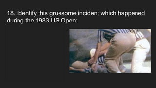 18. Identify this gruesome incident which happened
during the 1983 US Open:
 
