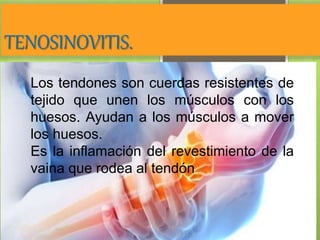 TENOSINOVITIS.
Los tendones son cuerdas resistentes de
tejido que unen los músculos con los
huesos. Ayudan a los músculos a mover
los huesos.
Es la inflamación del revestimiento de la
vaina que rodea al tendón
 