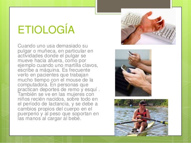 FISIOPATOLOGIA TENOSINOVITIS DE QUERVAIN PDF