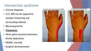 Tenosynovitis disorders of the Upper Extremity | PPT