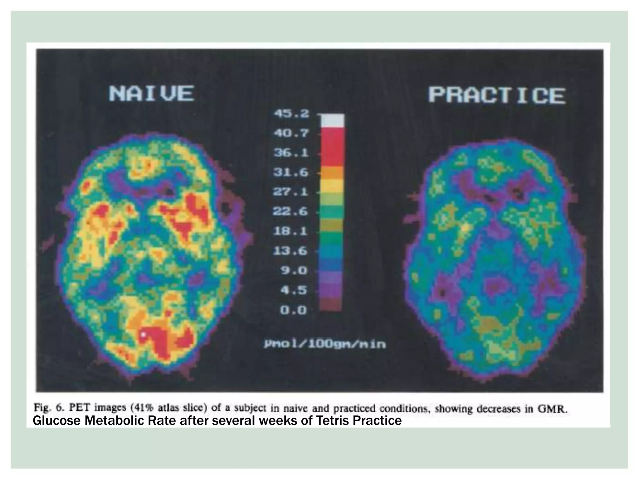 Glucose Metabolic Rate after several weeks of Tetris Practice
 