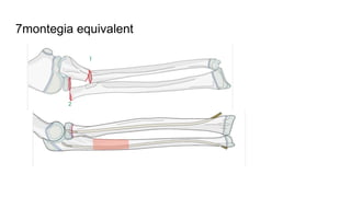 7montegia equivalent
 