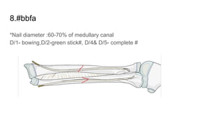 8.#bbfa
*Nail diameter :60-70% of medullary canal
D/1- bowing,D/2-green stick#, D/4& D/5- complete #
 