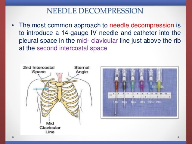 Image result for tension pneumothorax treatment