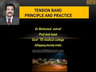 Dr Mohamed ashraf
Prof and head
Govt TD medical college
Alleppey,kerala,india
drashraf369@gmail.com
TENSION BAND
PRINCIPLE AND PRACTICE
 