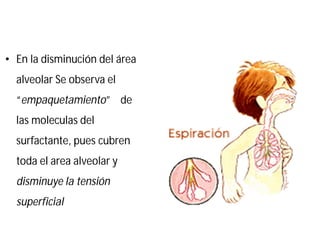 • En la disminución del área
alveolar Se observa el
“empaquetamiento” de
las moleculas del
surfactante, pues cubren
toda el area alveolar y
disminuye la tensión
superficial
 