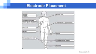 Sreeraj S R
Electrode Placement
 
