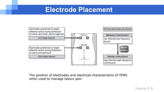 Sreeraj S R
The position of electrodes and electrical characteristics of TENS
when used to manage labour pain
Electrode Placement
 
