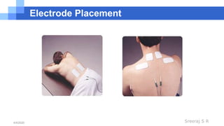 Sreeraj S R4/4/2020
Electrode Placement
 