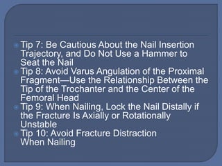  Tip 7: Be Cautious About the Nail Insertion
Trajectory, and Do Not Use a Hammer to
Seat the Nail
 Tip 8: Avoid Varus Angulation of the Proximal
Fragment—Use the Relationship Between the
Tip of the Trochanter and the Center of the
Femoral Head
 Tip 9: When Nailing, Lock the Nail Distally if
the Fracture Is Axially or Rotationally
Unstable
 Tip 10: Avoid Fracture Distraction
When Nailing
 