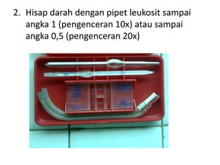 2. Hisap darah dengan pipet leukosit sampai
   angka 1 (pengenceran 10x) atau sampai
   angka 0,5 (pengenceran 20x)
 