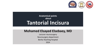 Anatomical points
about
Tantorial Incisura
Mohamed Elsayed Elsebaey, MD
Lecturer neurosurgery
Neurosurgery department
Benha Teaching Hospital
2024
 