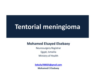 Tentorial meningioma
Mohamed Elsayed Elsebaey
Neurosurgery Registrar
Egypt, Ismailia
Ministry of Health
Seba3y700025@gmail.com
Mohamed E Elsebaey
 