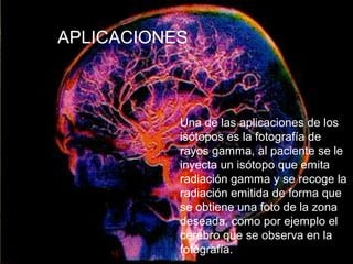 Isótopos usados en medicina
Una de las aplicaciones de los
isótopos es la fotografía de
rayos gamma, al paciente se le
inyecta un isótopo que emita
radiación gamma y se recoge la
radiación emitida de forma que
se obtiene una foto de la zona
deseada, como por ejemplo el
cerebro que se observa en la
fotografía.
APLICACIONES
 