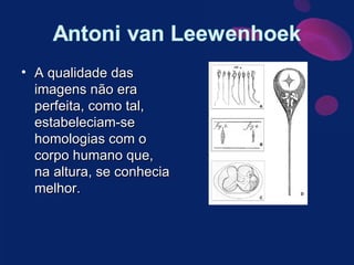 A qualidade das imagens não era perfeita, como tal, estabeleciam-se homologias com o corpo humano que, na altura, se conhecia melhor. 